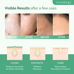 Face Masks Skincare Korean Skincare Organic Clay Mask Vegan Face Mask with Avocado & Green Tea Body Mud Mask Face Masks Beauty Face Masks Skin Care Dermatologically Tested 100G/3.4 Oz