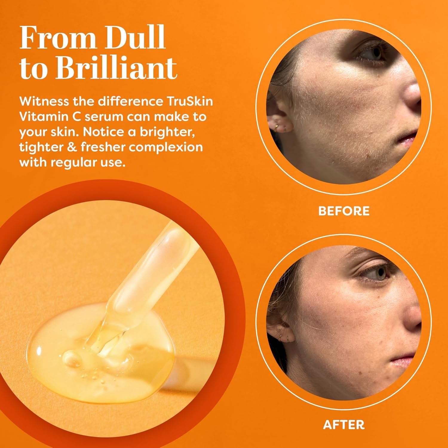 Vitamin C Serum for Face – anti Aging Face Serum with Vitamin C, Hyaluronic Acid, Vitamin E – Brightening Serum for Dark Spots, Even Skin Tone, Eye Area, Fine Lines & Wrinkles, 2 Fl Oz 60 Ml