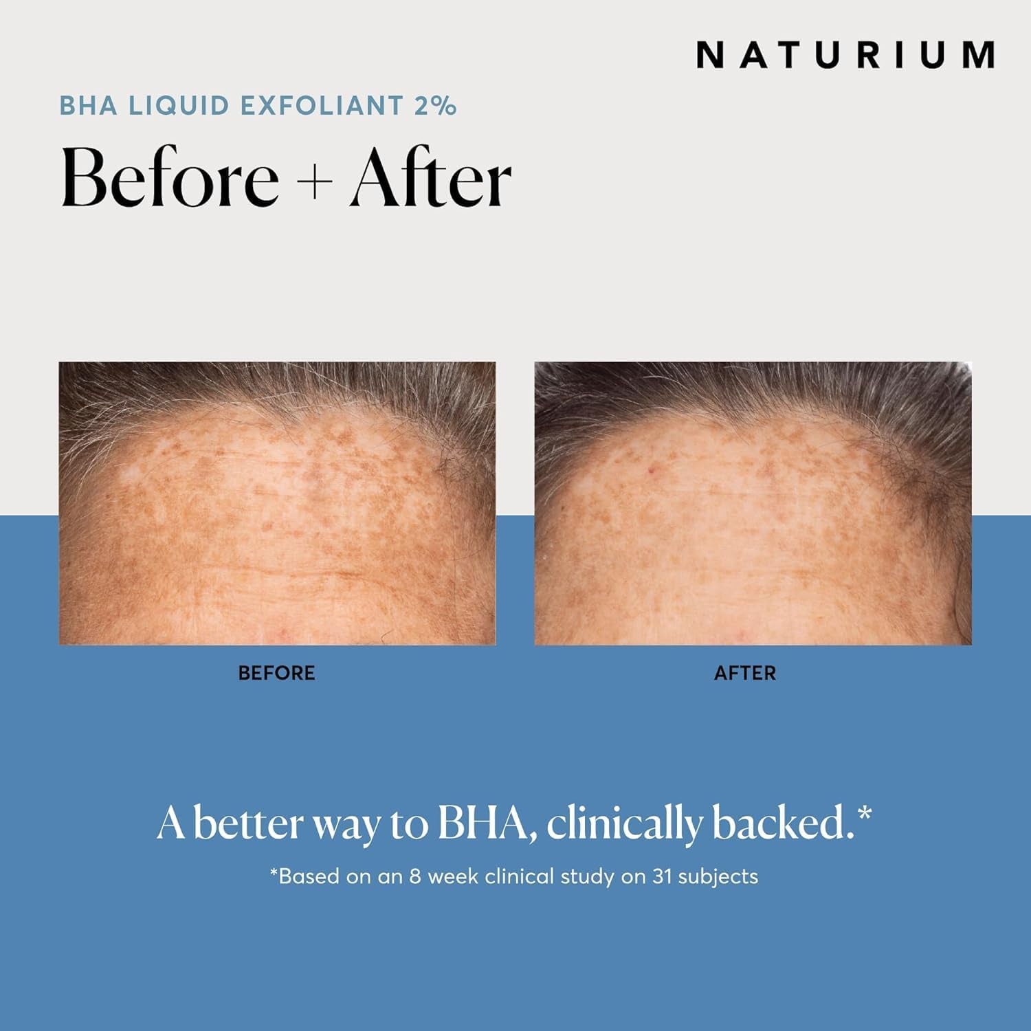 BHA Liquid Exfoliant 2%, Leave-On Face & Skin Care Pore Exfoliant, with Salicylic Acid & Bioactive Fruit Acids | 4.0 FL OZ / 120 ML